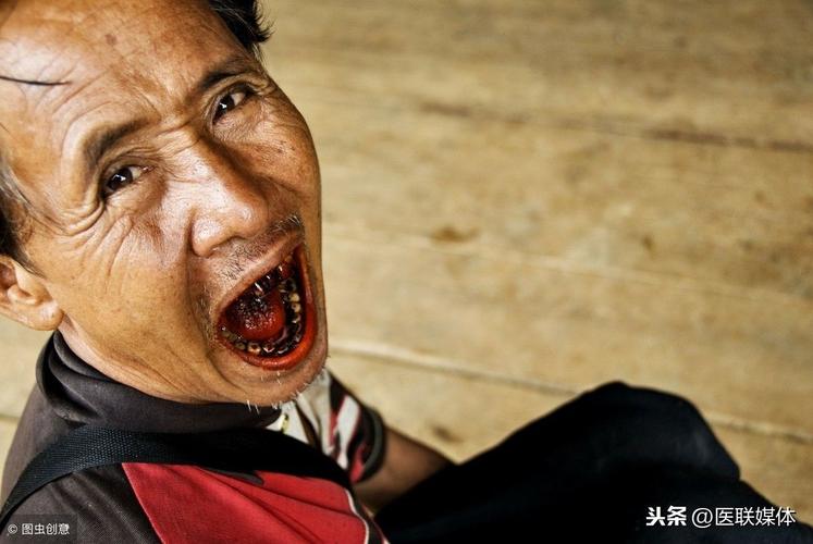 嚼槟榔20年患口腔癌,嚼槟榔20年患口腔癌几率大吗
