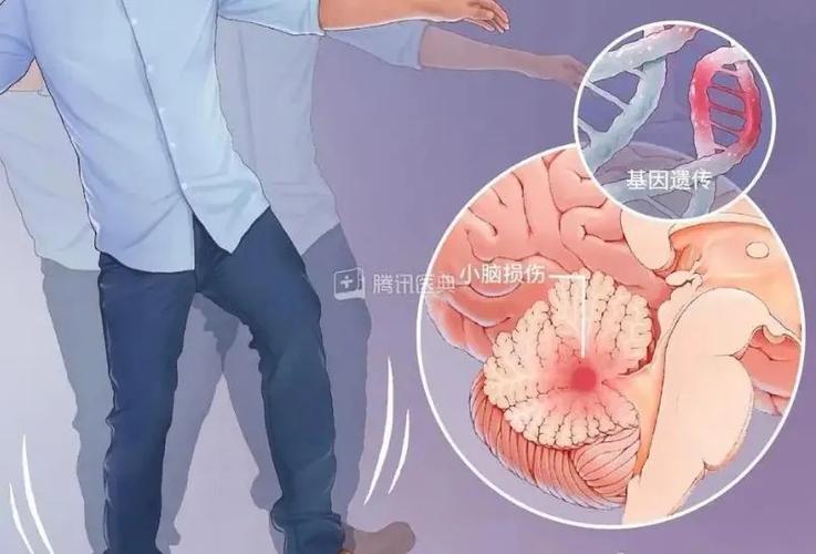 新澳门彩出号综合走势图和送小脑萎缩儿子高考与小脑萎缩能上学吗